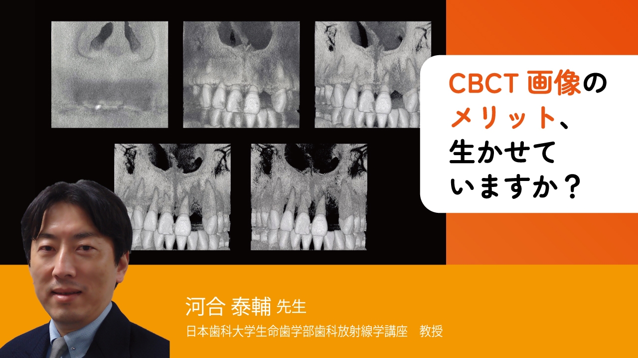 CBCT画像のメリット、生かせていますか？